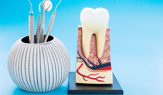 are root canals painful albury