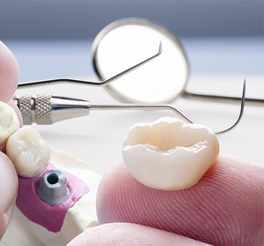 lost and damaged dental restorations what to do albury