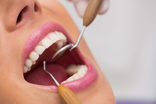 tooth decay treatment albury