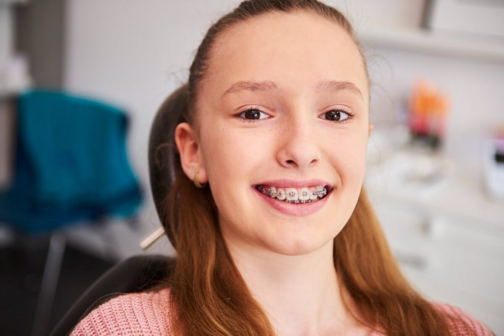 6 things to do prior to getting braces kreativ dental albury