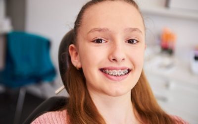 6 Things to Do Prior to Getting Braces