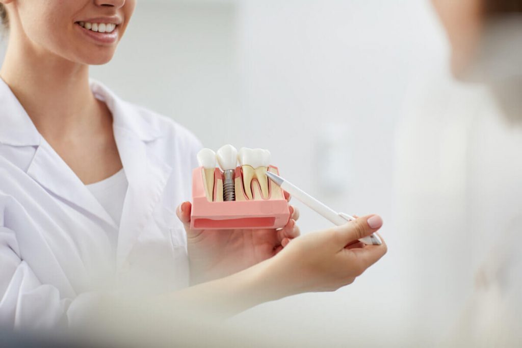 top 6 reasons dental implants are the optimal option for replacing missing teeth
