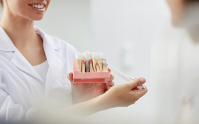 Top 6 Reasons Dental Implants are the Optimal Option for Replacing Missing Teeth