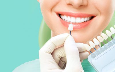 Teeth Whitening vs. Dental Veneers: Which is Right for You?