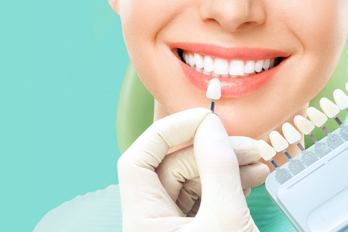 A dentist comparing tooth shades beside a patient’s smile