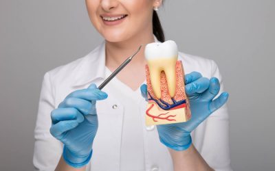 Why Choose Root Canal Treatment?