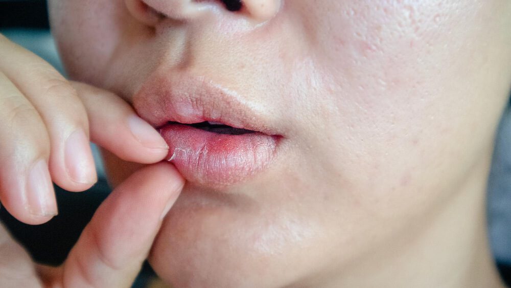 Dry Mouth Treatment and Prevention Tips for Better Oral Health