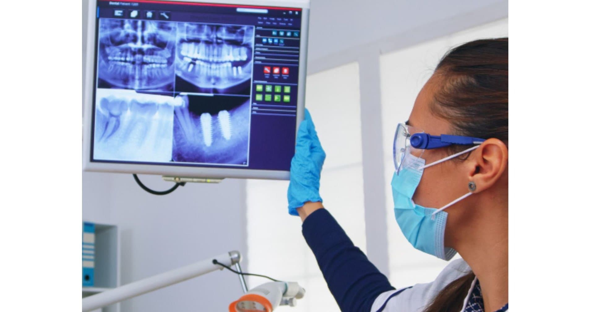 dentist reviewing digital dental imaging on screen as part of implant assessment planning in Albury